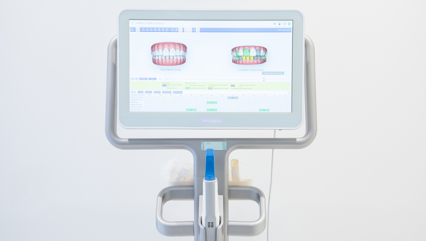 沖縄県矯正歯科治療「沖縄マウスピース矯正歯科」｜口腔内スキャナー「iTero Erement 5D」を導入