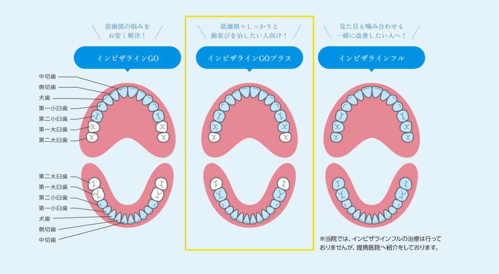 沖縄県那覇市の矯正歯科「沖縄マウスピース矯正歯科」｜インビザライン