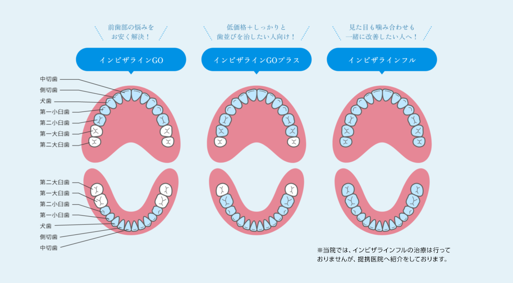 沖縄県矯正歯科治療「沖縄マウスピース矯正歯科」｜インビザライン3つの選択肢