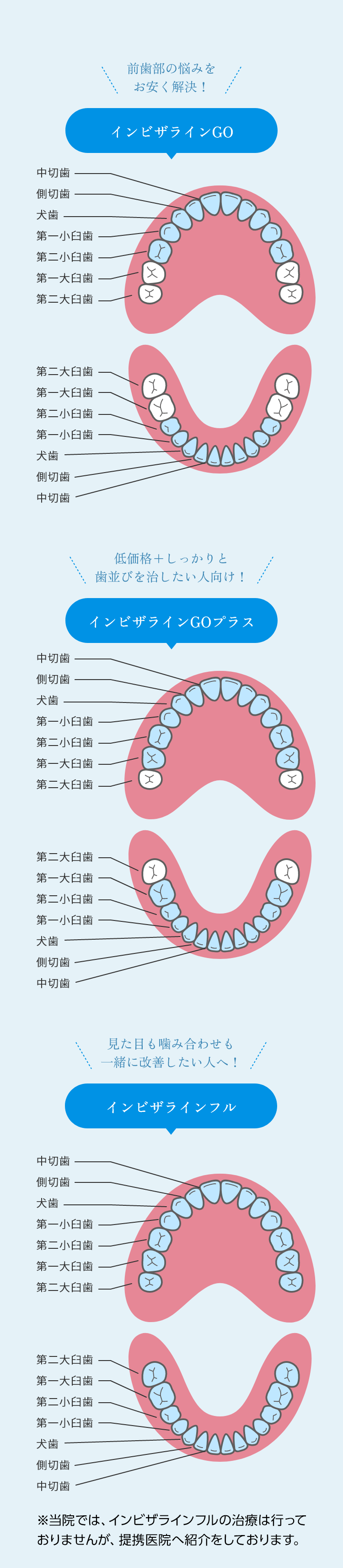 沖縄県矯正歯科治療「沖縄マウスピース矯正歯科」｜インビザライン3つの選択肢